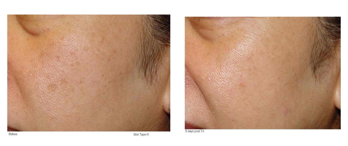 Professional skincare expertise