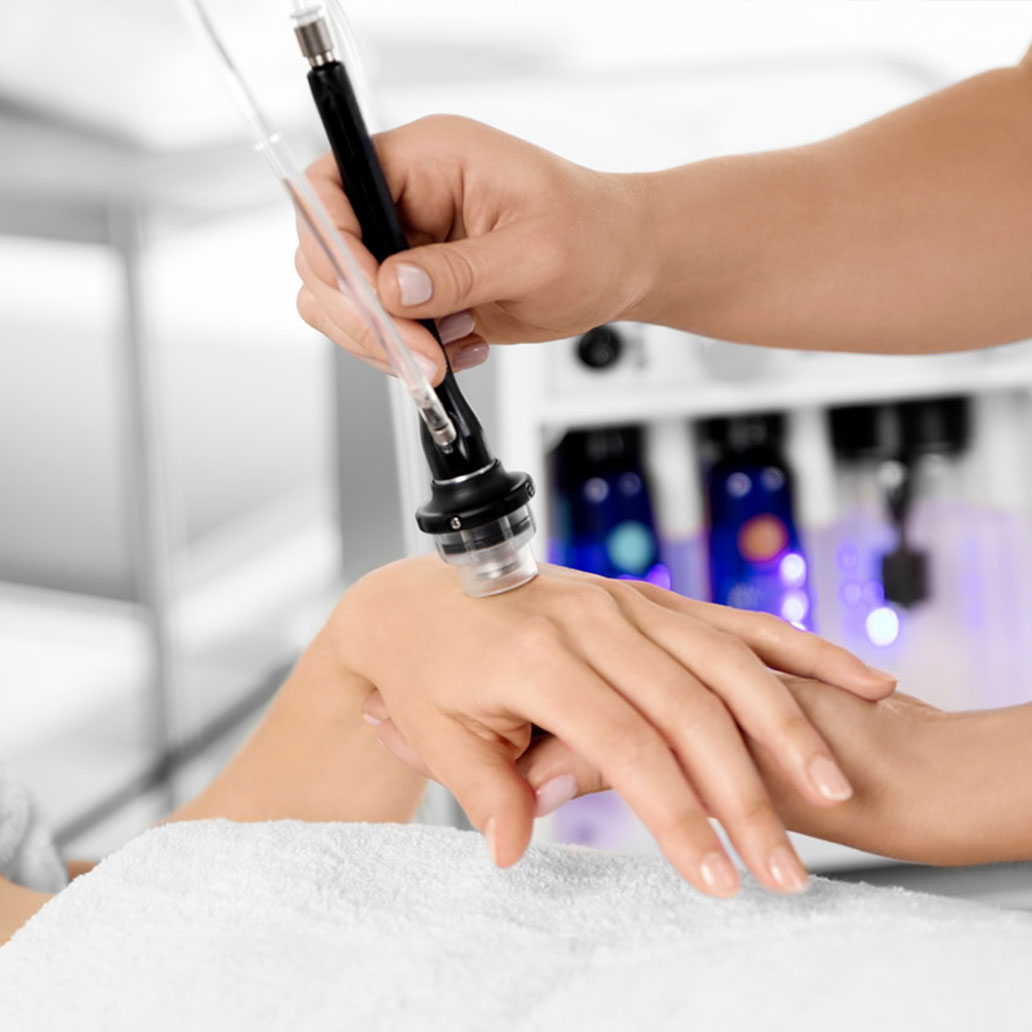 Perfect Derma Peel