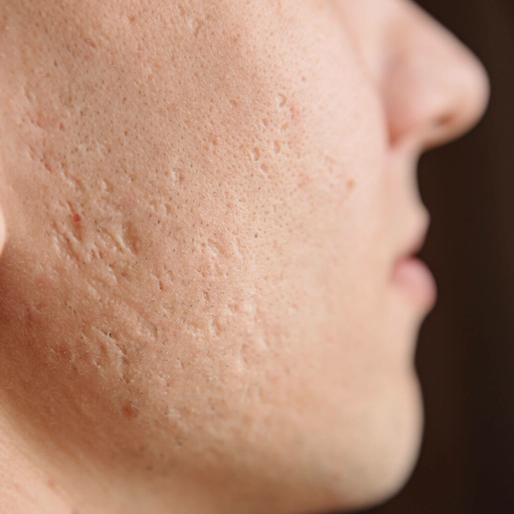 skin