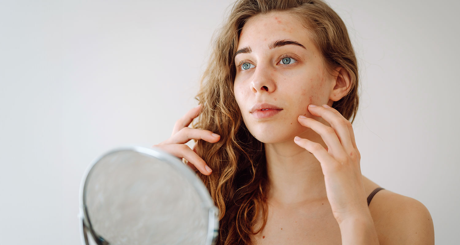Soothing Sensitive Skin: Tailored Treatments at Sublime MediSpa