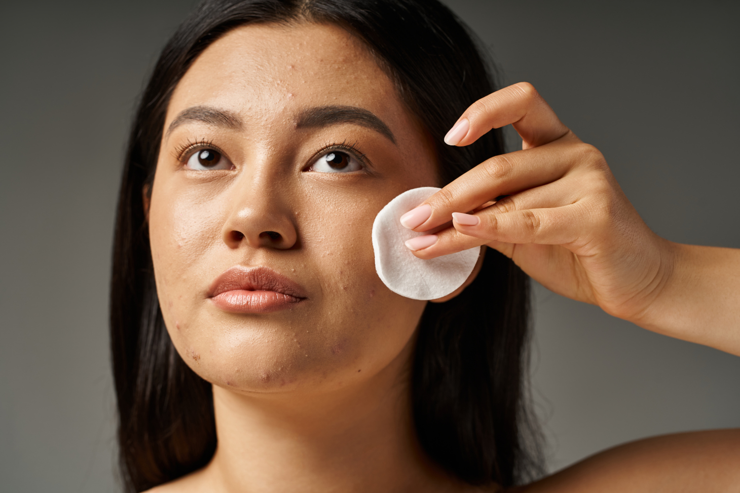 Excess Skin Oil Production Sublime MediSpa Has the Solution