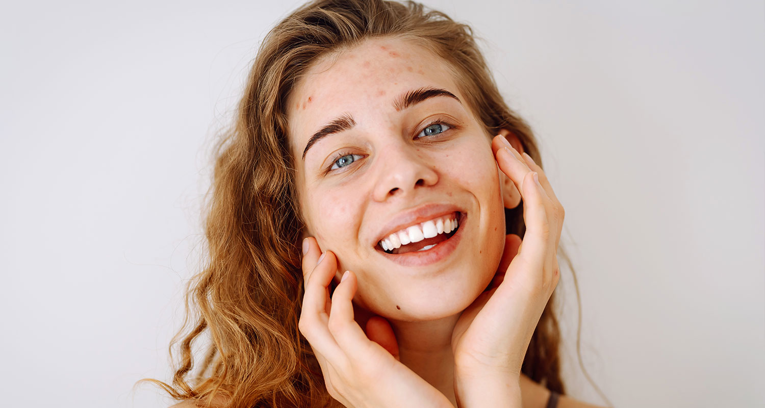 Laser Skin Tightening